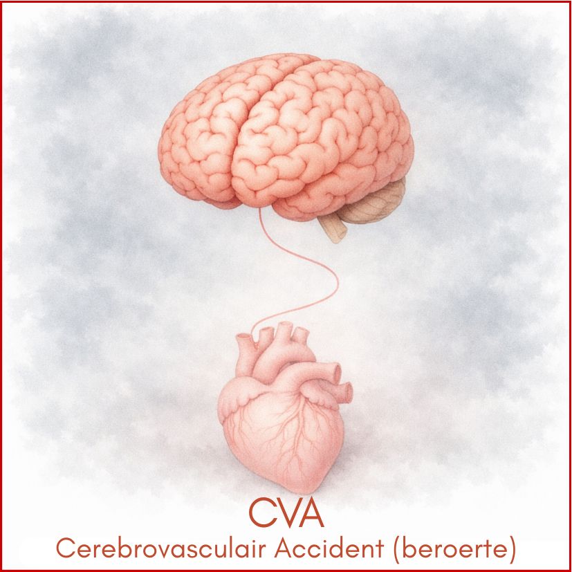 Wat is een CVA?
